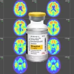 La FDA aprueba Donanemab: tratamiento del Alzheimer en fase inicial